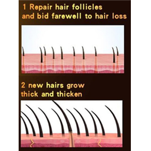 africa hair loss treatment of traction alopecia super fast hair growth shampoo 16.jpg