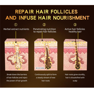 africa hair loss treatment of traction alopecia super fast hair growth shampoo 20.jpg