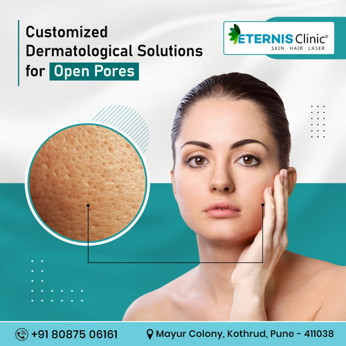 Skin Specialist In Kothrud 7.jpg