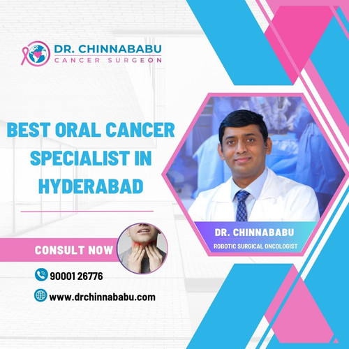Best Oral Cancer Specialist in Hyderabad - Dr. Chinnababu.jpg