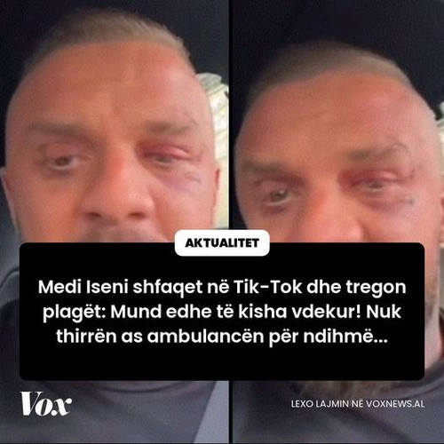 454892654 903758215116787 7062117666177954879 n.jpg?stp=dst jpg p526x296& nc cat=101&ccb=1 7& nc sid.jpg