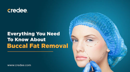 Everything You Need To Know About Buccal Fat Removal.jpg