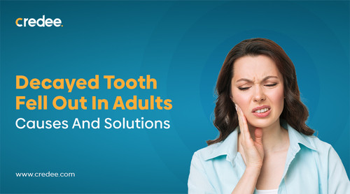 Decayed Tooth Fell Out In Adults.jpg