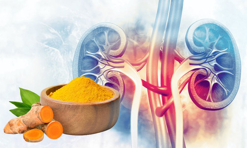 curcumin2407