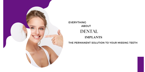 Everything about dental implants – the permanent solution to your missing teeth.png