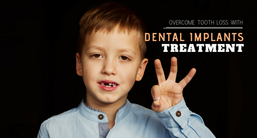 dental implants treatment.png