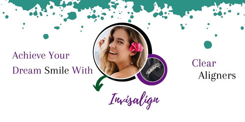 Achieve Your Dream Smile With Invisalign Clear Aligners.jpg