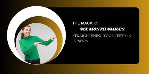 The Magic of Six Month Smiles Straightening Your Teeth in London.jpg
