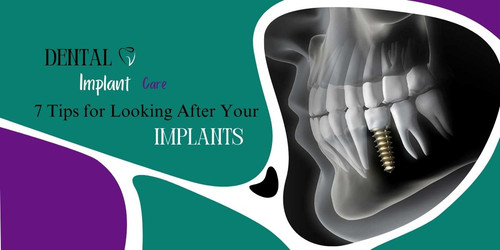 Dental Implant Care 7 Tips for Looking After Your Implants.jpg