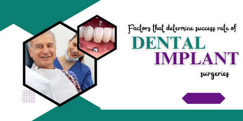 Factors that determine success rate of dental implant surgeries.png
