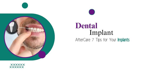 Dental Implant AfterCare 7 Tips for Your Implants.jpg