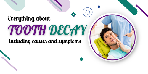 Everything about tooth decay including causes and symptoms.png