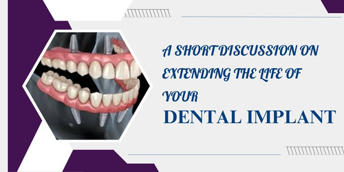 A short discussion on extending the life of your dental implant.jpg