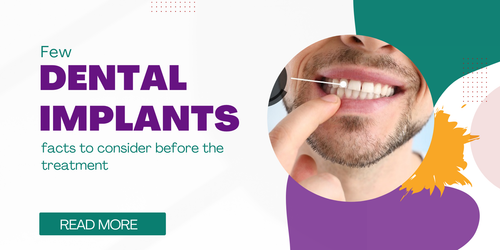 Few dental implants facts to consider before the treatment.png