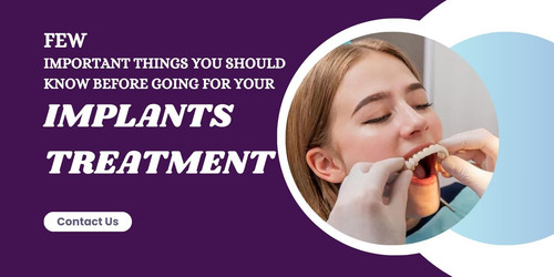 Few important things you should know before going for your implants treatment.jpg