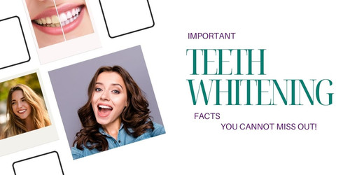 Important teeth whitening facts you cannot miss out!.jpg
