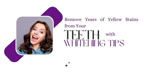 Remove Years of Yellow Stains from Your Teeth with Whitening Tips.jpg