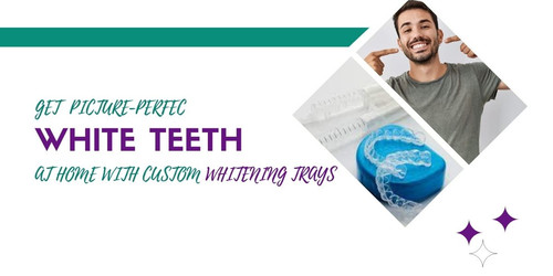 Get Picture Perfect White Teeth at Home with Custom Whitening Trays.jpg