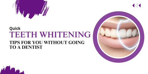Quick teeth whitening tips for you without going to a dentist.jpg