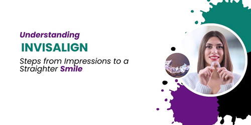 Understanding Invisalign Steps from Impressions to a Straighter Smile.jpg