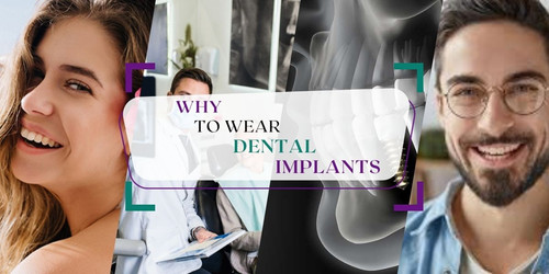 WHY TO WEAR DENTAL IMPLANTS.jpg