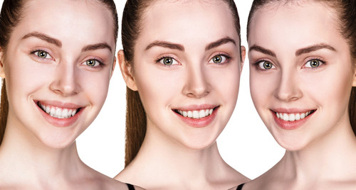 smile makeover why should i go for it.jpg