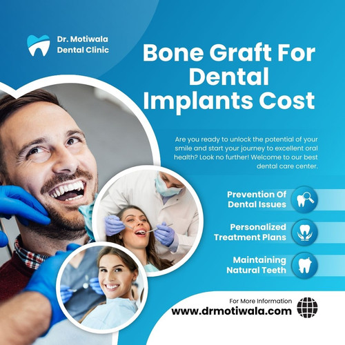 Bone Graft For Dental Implants Cost.jpg