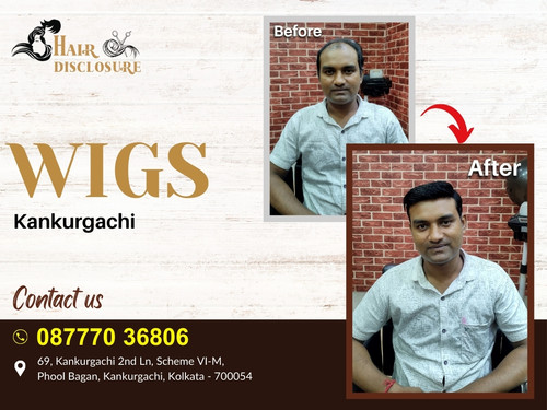 Hair Disclosure | Best Wigs Kankurgachi.jpg