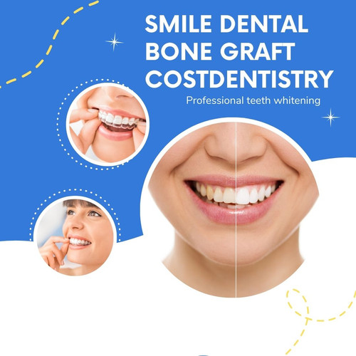 Dental Bone Graft Cost.jpg