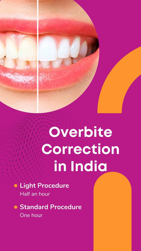 Overbite Correction in India.jpg
