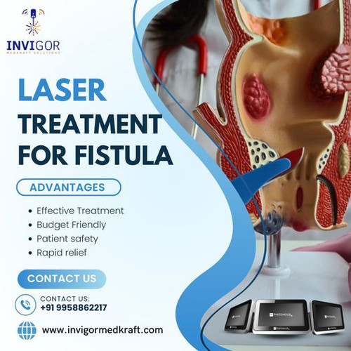 Laser for Fistula.jpg