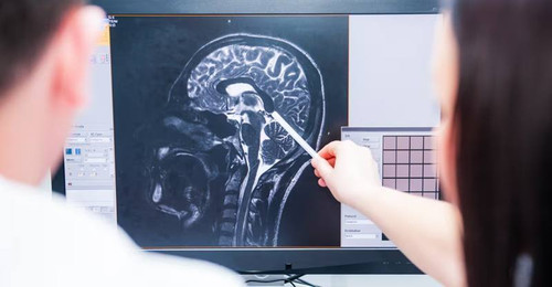 Il nostro cervello cambia quando moriamo.jpg