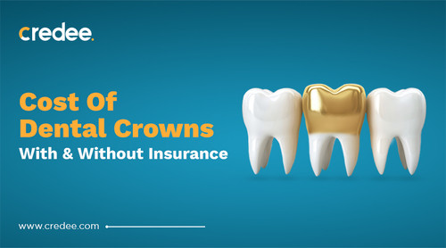 Cost Of Dental Crowns With & Without Insurance.jpg