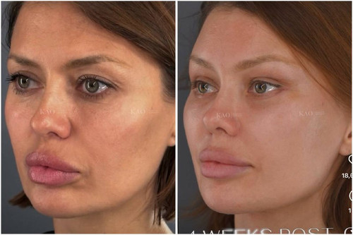 puQbZ1eJ0LvSrlfW 4 aA6zxugSqXNKw5B oS0uMr6xx6 GSRybhug ZhCJLqOgnmQ3GzN00aS4bSNdbBKpNnd073XVNkkejf4hY.jpg