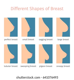 breast shapes icons flat style 260nw 641076493.jpg.webp