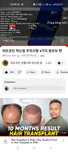 Screenshot 2024 06 30 18 09 33 21 f9ee0578fe1cc94de7482bd41accb329.jpg