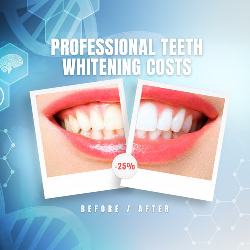 Professional Teeth Whitening Cost.jpg