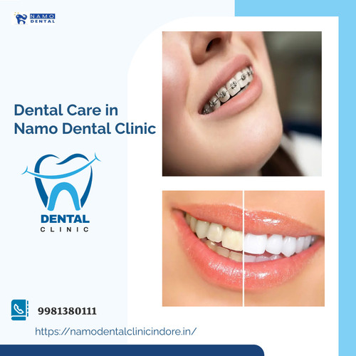 Dental Care in Namo Dental Clinic.jpg