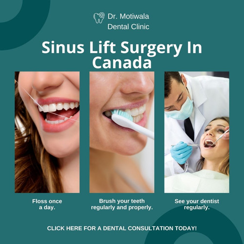 Sinus Lift Surgery In Canada.jpg
