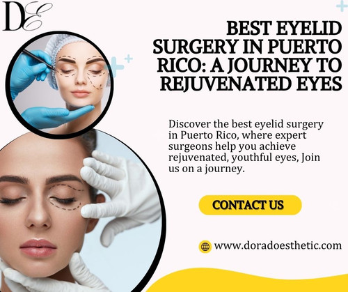 Best Eyelid Surgery in Puerto Rico A Journey to Rejuvenated Eyes.jpg