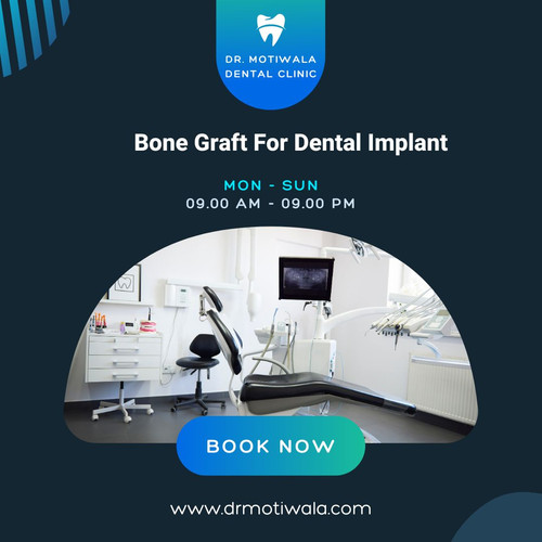 Bone Graft For Dental Implant.jpg