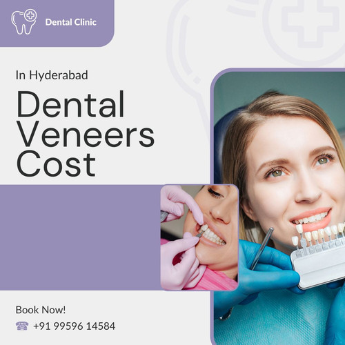 Dental Veneers Cost In Hyderabad.jpg