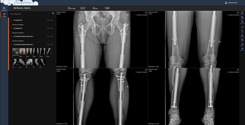 Opera Snapshot 2024 07 05 125432 pacs uniview.usi.it.png