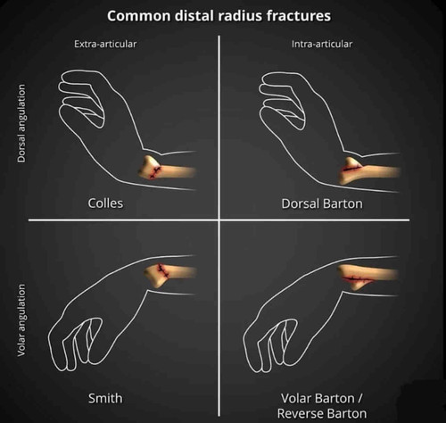 639E65AD 80A5 4978 ACA6 8009DFCDE6D8.jpg