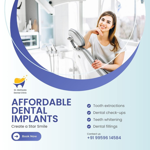 Affordable Dental Implants.jpg