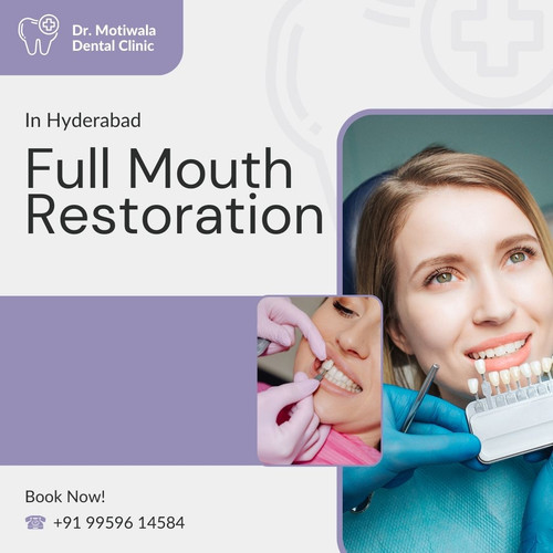 Full Mouth Restoration In Hyderabad.jpg