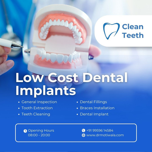 Low Cost Dental Implants.jpg