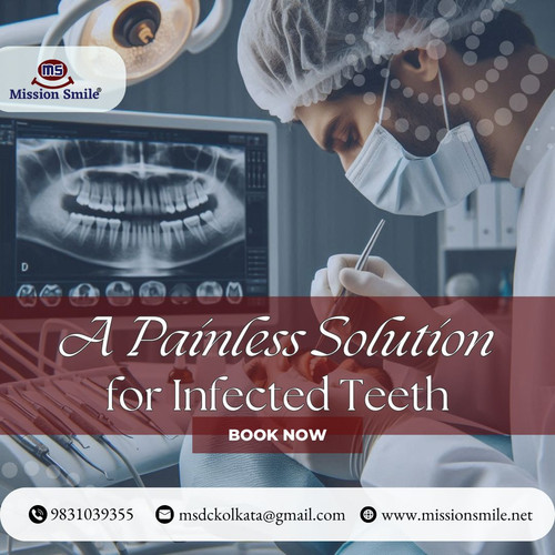 Root Canal Treatment A Painless Solution for Infected Teeth.jpg