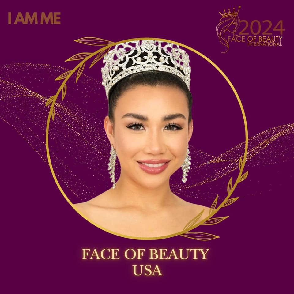 candidatas a face of beauty international 2024. final: 19 sep. - Página 3 DMtVzYb