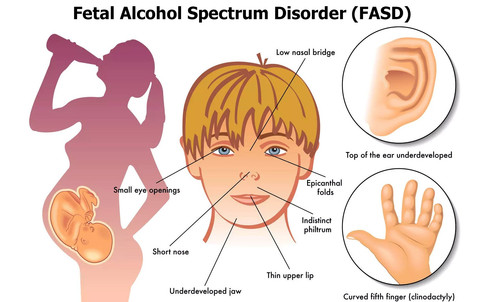 fasd2401.jpg
